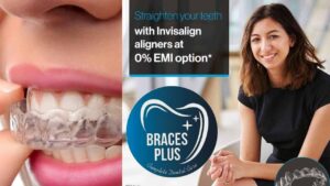 braces-plus-dental-clinic-bandra-east-5